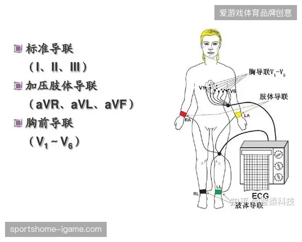 三年内赛事安保协议将强制采纳可穿戴设备的心电指标作为准入基准 三年内赛事安保协议将强制采纳可穿戴设备的心电指标作为准入基准